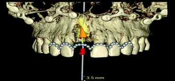 Биологические принципы имплантации и костной регенерации Биологические принципы имплантации и костной регенерации